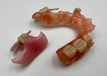 Flexible Dentures